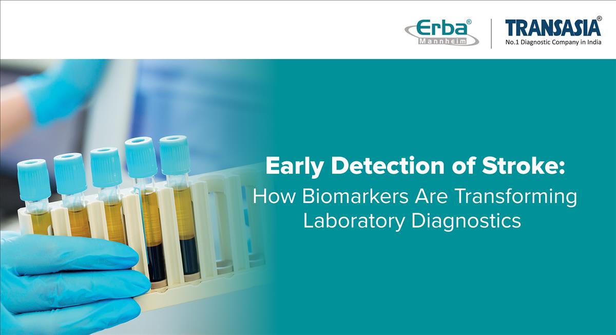 Timely detection of stroke and role of biomarkers